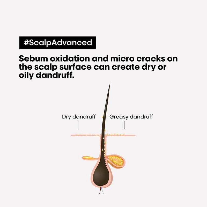 Loreal Professionnel Scalp Advanced Anti Dandruff Dermo Clarifier Shampoo For Dandruff Prone Scalp, 300 ml-3.webp